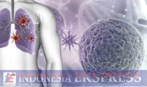 Deteksi TBC Capai Rekor Tertinggi di Tahun 2022