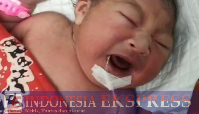 Bayi Baru Lahir Butuh Perhatian dan Uluran Tangan, Ada Kelainan di Kepala Sang Bayi